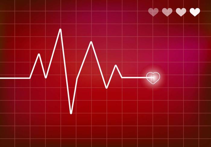 surveillance Rhythm power monitor medicine heartbeat heart monitor health electrocardiogram ekg Ecg chart cardiograph background 