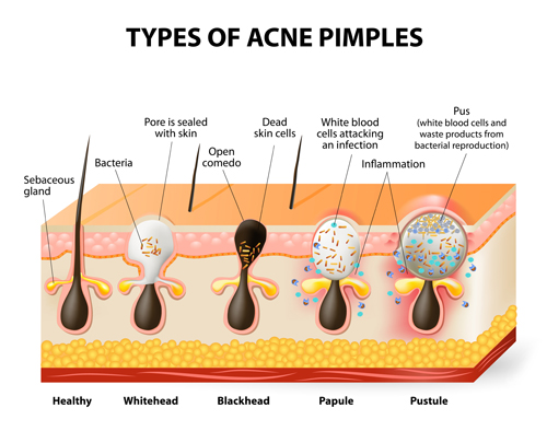 Skin structure diagram vectors material 05